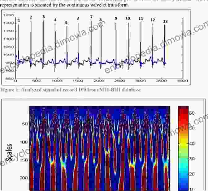 Wavelet Transform Of A Neural Signal, Showing Its Time Frequency Decomposition Wavelets In Neuroscience (Springer In Synergetics)